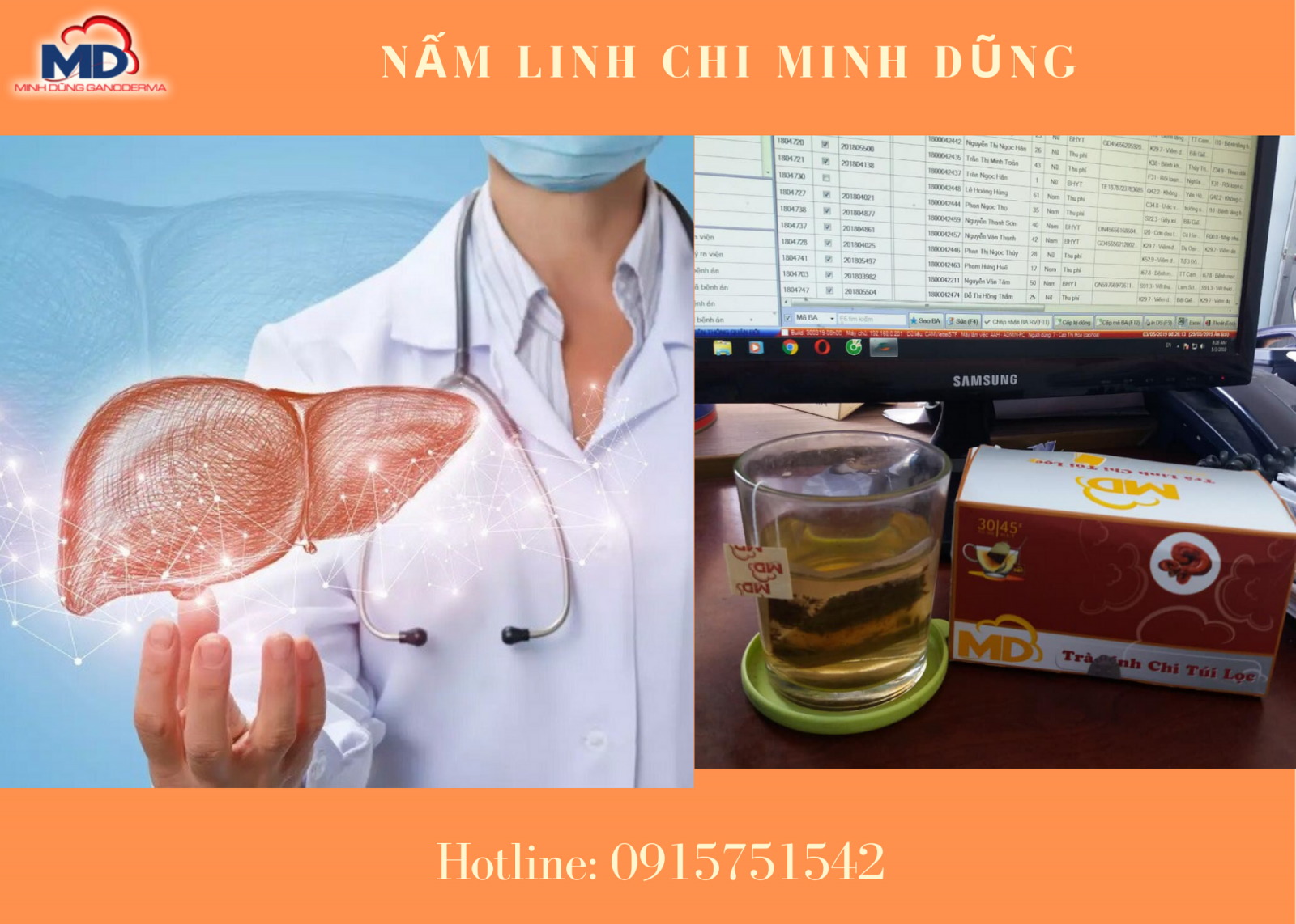 Cao linh chi hỗ trợ bệnh gan